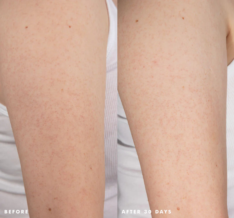 Farmhouse Fresh Smooth Reveal® Resurfacing Silky Serum